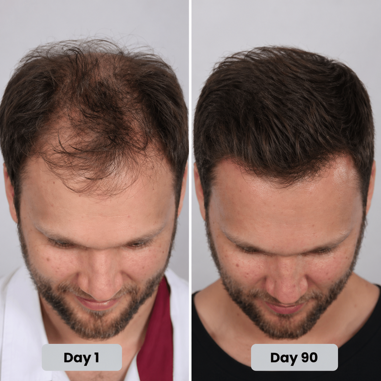 Therapy Cap for Hair Regrowth