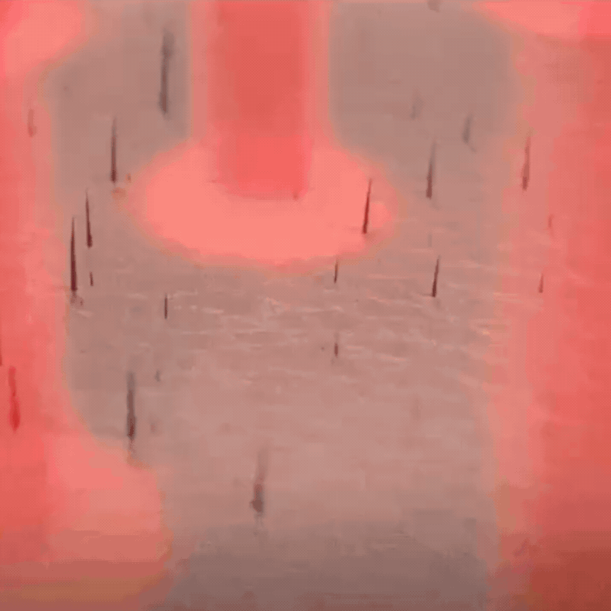 Therapy Cap for Hair Regrowth